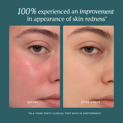 Vilora™ - Skin-Calming Hypochlorous Spray